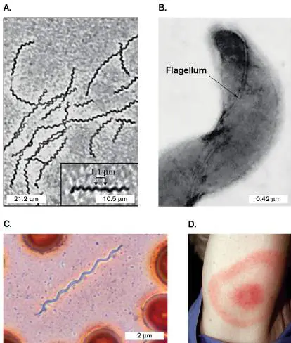 Figure from Chapter 18, Microbiology: An Evolving Science 6e