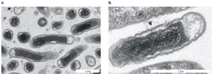 Figure from Chapter 18, Microbiology: An Evolving Science 6e