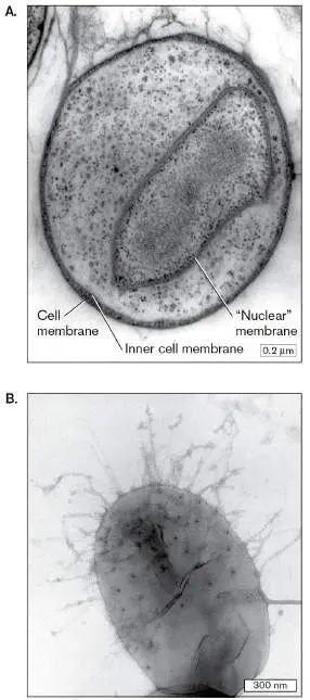 Figure from Chapter 18, Microbiology: An Evolving Science 6e