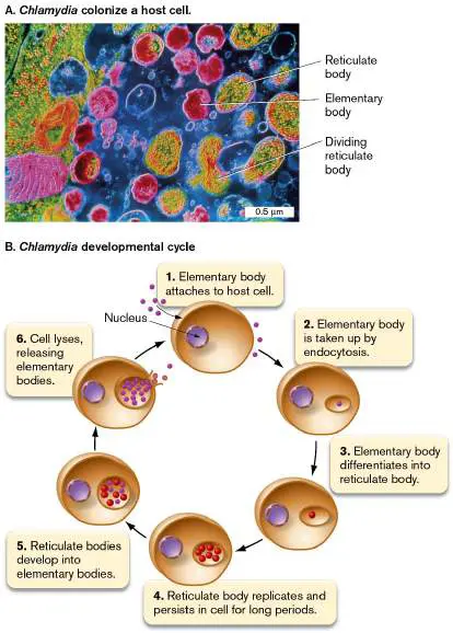 Figure from Chapter 18, Microbiology: An Evolving Science 6e