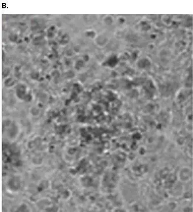 Figure from Chapter 19, Microbiology: An Evolving Science 6e