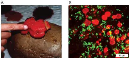 Figure from Chapter 19, Microbiology: An Evolving Science 6e