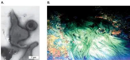 Figure from Chapter 19, Microbiology: An Evolving Science 6e