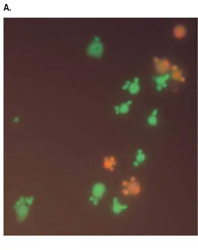 Figure from Chapter 19, Microbiology: An Evolving Science 6e