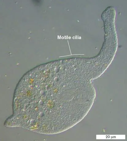 Figure from Chapter 20, Microbiology: An Evolving Science 6e