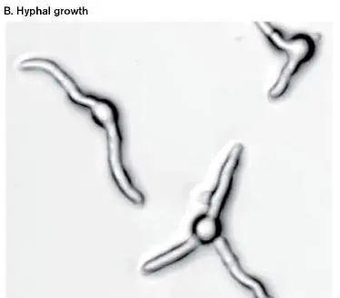 Figure from Chapter 20, Microbiology: An Evolving Science 6e