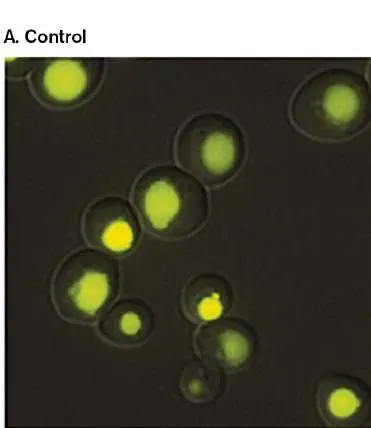 Figure from Chapter 20, Microbiology: An Evolving Science 6e