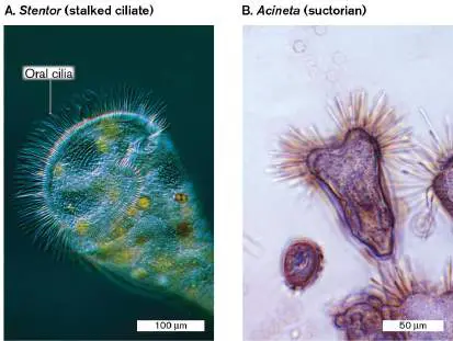 Figure from Chapter 20, Microbiology: An Evolving Science 6e