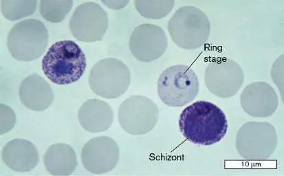 Figure from Chapter 20, Microbiology: An Evolving Science 6e