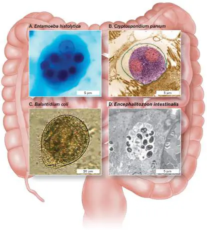Figure from Chapter 20, Microbiology: An Evolving Science 6e