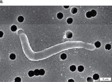 Figure from Chapter 21, Microbiology: An Evolving Science 6e