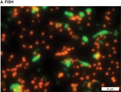 Figure from Chapter 21, Microbiology: An Evolving Science 6e
