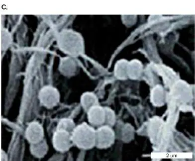 Figure from Chapter 21, Microbiology: An Evolving Science 6e
