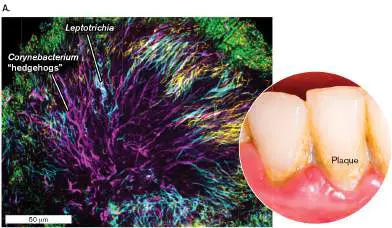 Figure from Chapter 21, Microbiology: An Evolving Science 6e