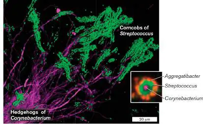 Figure from Chapter 21, Microbiology: An Evolving Science 6e
