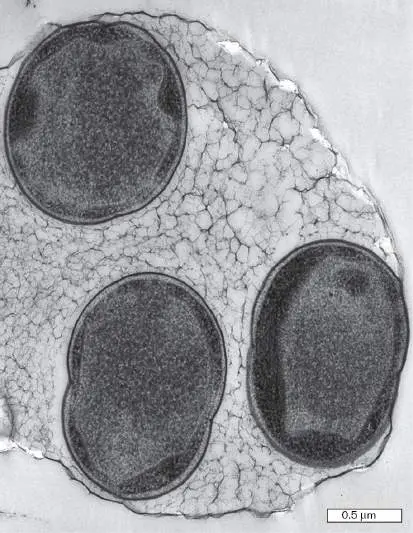 Figure from Chapter 22, Microbiology: An Evolving Science 6e