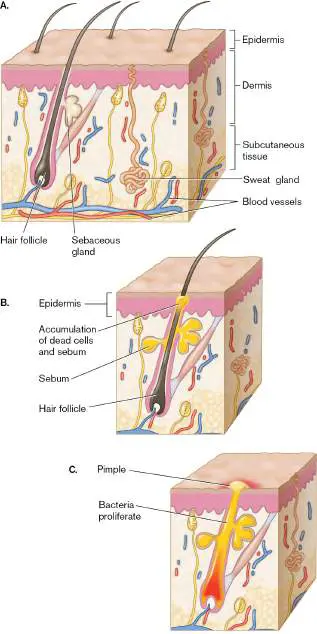 Figure from Chapter 23, Microbiology: An Evolving Science 6e