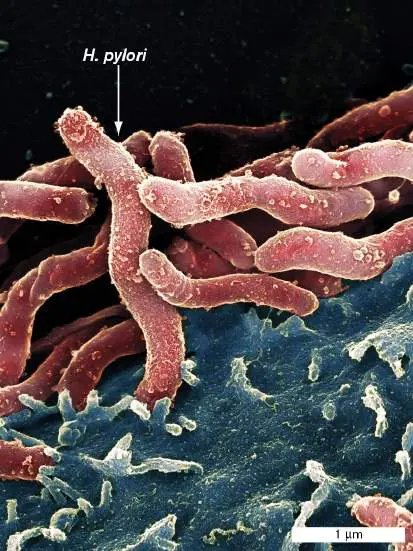 Figure from Chapter 23, Microbiology: An Evolving Science 6e