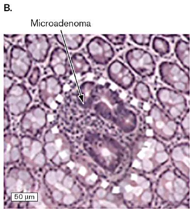 Figure from Chapter 23, Microbiology: An Evolving Science 6e