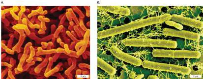 Figure from Chapter 23, Microbiology: An Evolving Science 6e