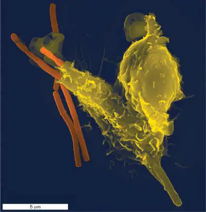 Figure from Chapter 23, Microbiology: An Evolving Science 6e