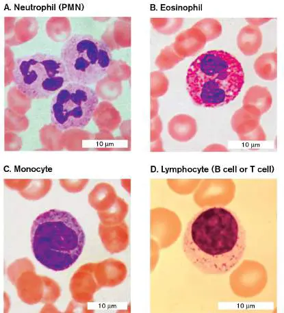 Figure from Chapter 23, Microbiology: An Evolving Science 6e