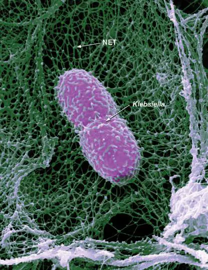 Figure from Chapter 23, Microbiology: An Evolving Science 6e