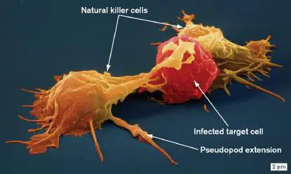 Figure from Chapter 23, Microbiology: An Evolving Science 6e
