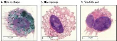 Figure from Chapter 23, Microbiology: An Evolving Science 6e