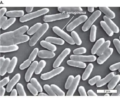 Figure from Chapter 23, Microbiology: An Evolving Science 6e