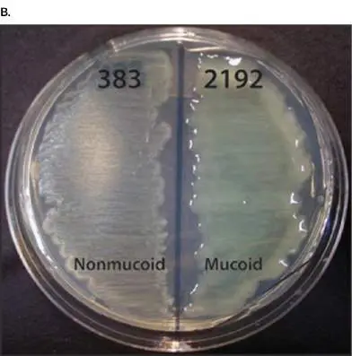 Figure from Chapter 23, Microbiology: An Evolving Science 6e