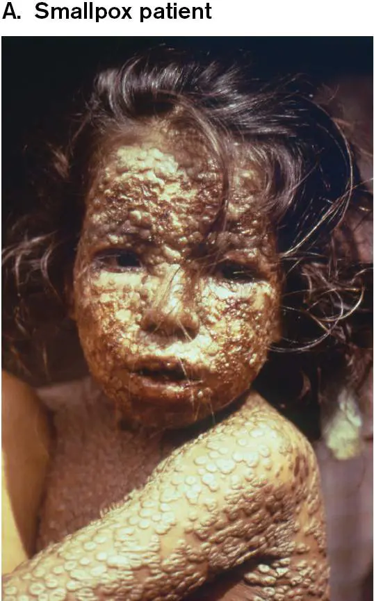 Figure from Chapter 24, Microbiology: An Evolving Science 6e