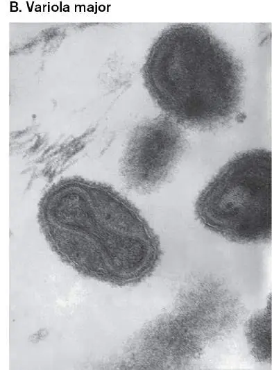 Figure from Chapter 24, Microbiology: An Evolving Science 6e