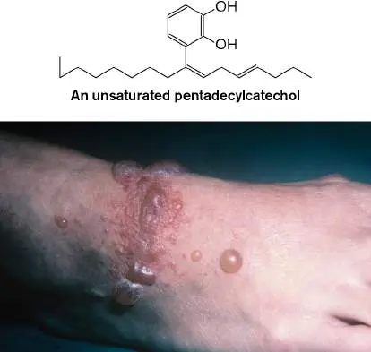 Figure from Chapter 24, Microbiology: An Evolving Science 6e