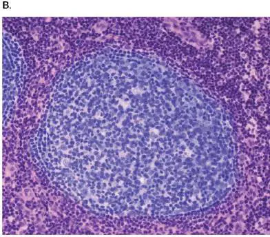 Figure from Chapter 24, Microbiology: An Evolving Science 6e