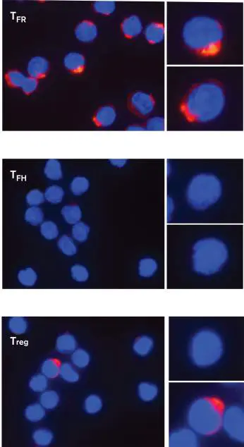 Figure from Chapter 24, Microbiology: An Evolving Science 6e