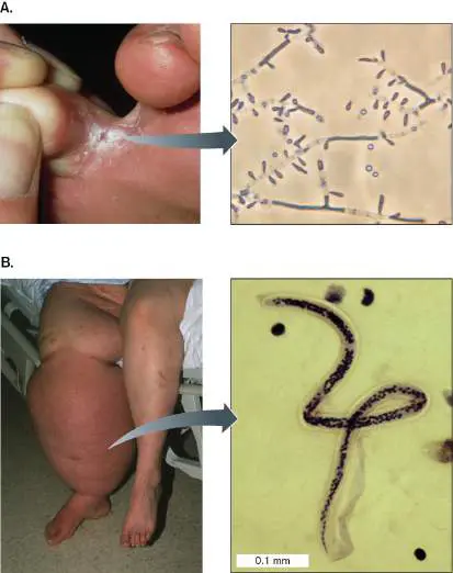 Figure from Chapter 25, Microbiology: An Evolving Science 6e