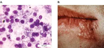 Figure from Chapter 25, Microbiology: An Evolving Science 6e