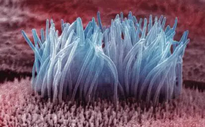 Figure from Chapter 25, Microbiology: An Evolving Science 6e