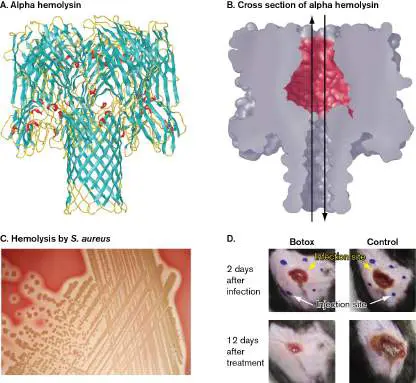 Figure from Chapter 25, Microbiology: An Evolving Science 6e