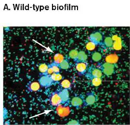 Figure from Chapter 25, Microbiology: An Evolving Science 6e