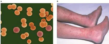Figure from Chapter 25, Microbiology: An Evolving Science 6e