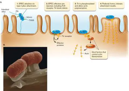 Figure from Chapter 25, Microbiology: An Evolving Science 6e
