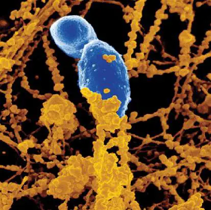 Figure from Chapter 25, Microbiology: An Evolving Science 6e