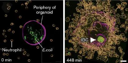 Figure from Chapter 26, Microbiology: An Evolving Science 6e