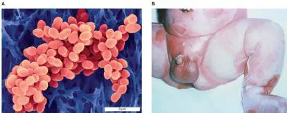 Figure from Chapter 26, Microbiology: An Evolving Science 6e