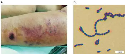 Figure from Chapter 26, Microbiology: An Evolving Science 6e