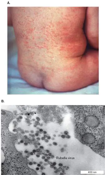 Figure from Chapter 26, Microbiology: An Evolving Science 6e