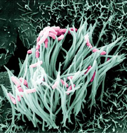 Figure from Chapter 26, Microbiology: An Evolving Science 6e