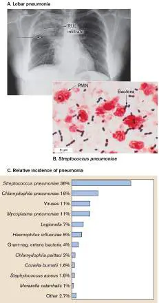 Figure from Chapter 26, Microbiology: An Evolving Science 6e